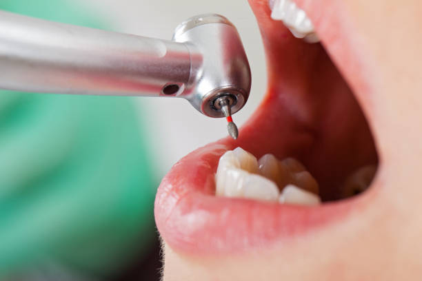 Best Broken or Cracked Tooth Emergency Dentist in Pecan Acres, TX